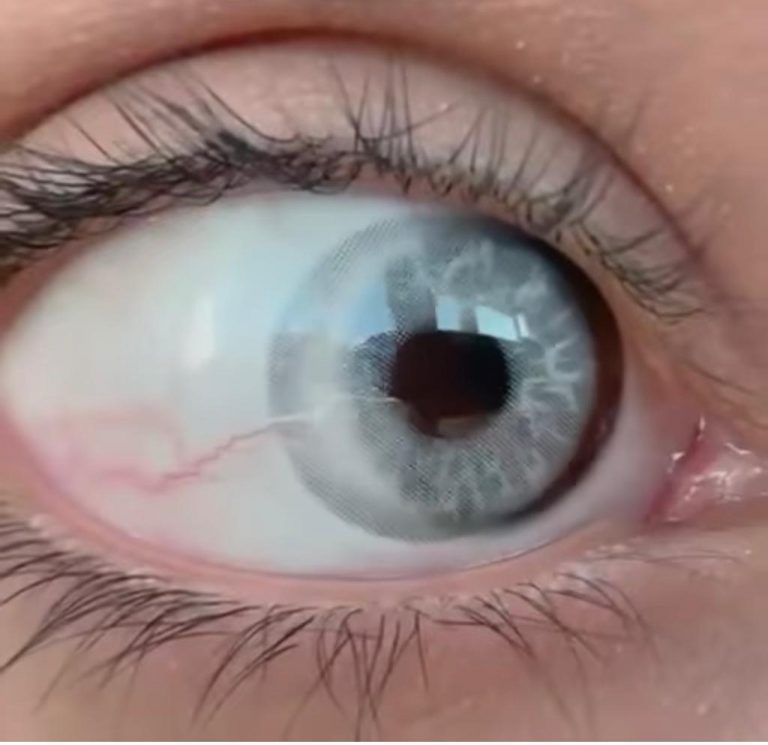 لنز چشم رنگی طوسی مطلق با رگه های مثل چشم  eye lens aurora gray